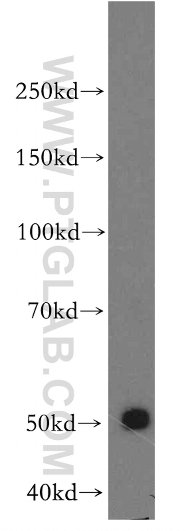 SLC44A1 Antibody in Western Blot (WB)