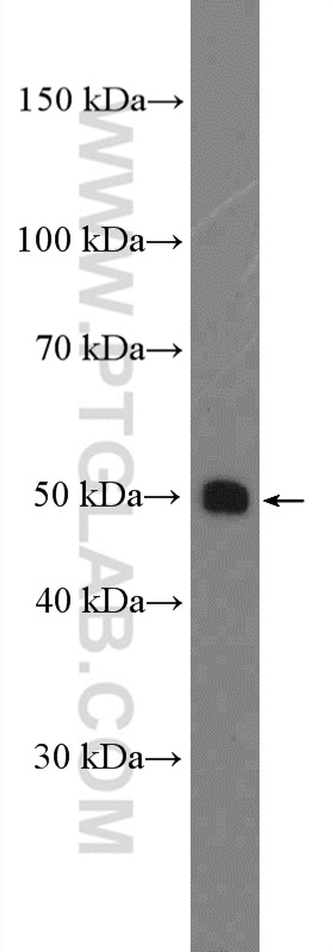 SLC44A1 Antibody in Western Blot (WB)