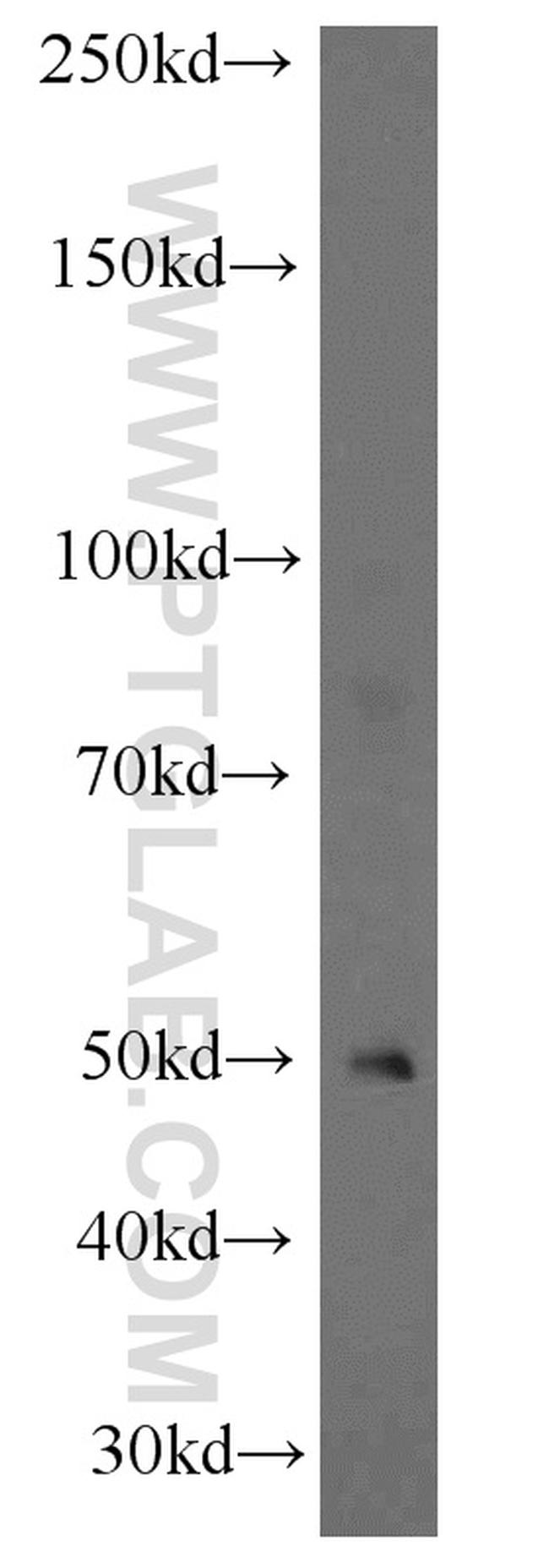 SLC44A1 Antibody in Western Blot (WB)