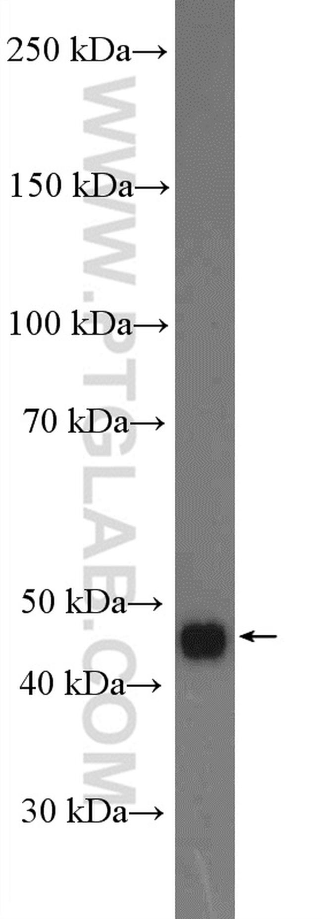 SLC44A1 Antibody in Western Blot (WB)