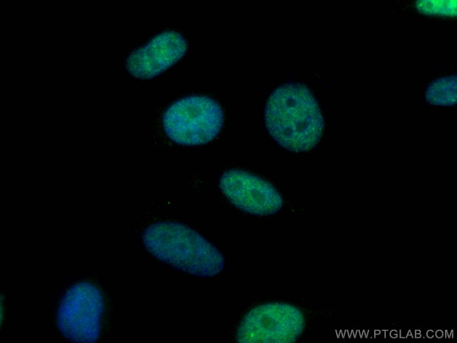 DIS3 Antibody in Immunocytochemistry (ICC/IF)