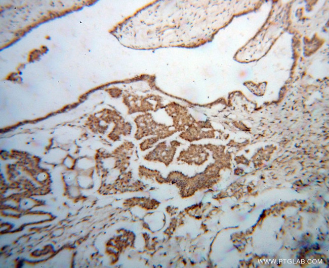 DIS3 Antibody in Immunohistochemistry (Paraffin) (IHC (P))