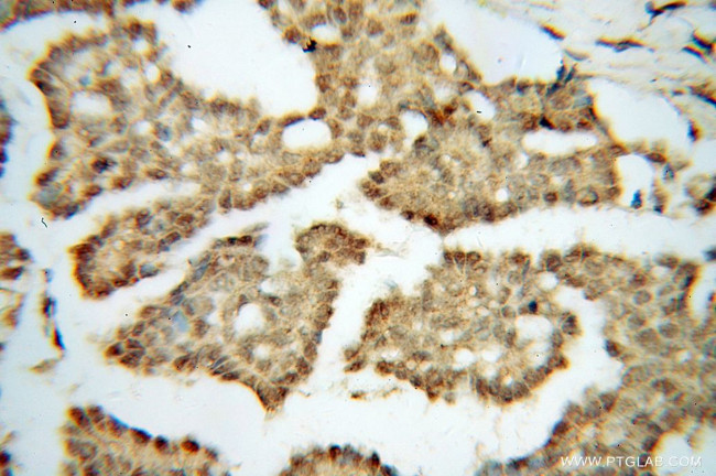 DIS3 Antibody in Immunohistochemistry (Paraffin) (IHC (P))