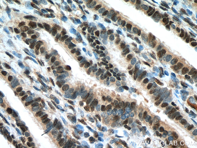 DIS3 Antibody in Immunohistochemistry (Paraffin) (IHC (P))