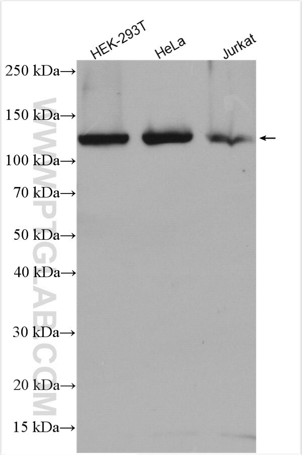 DIS3 Antibody in Western Blot (WB)