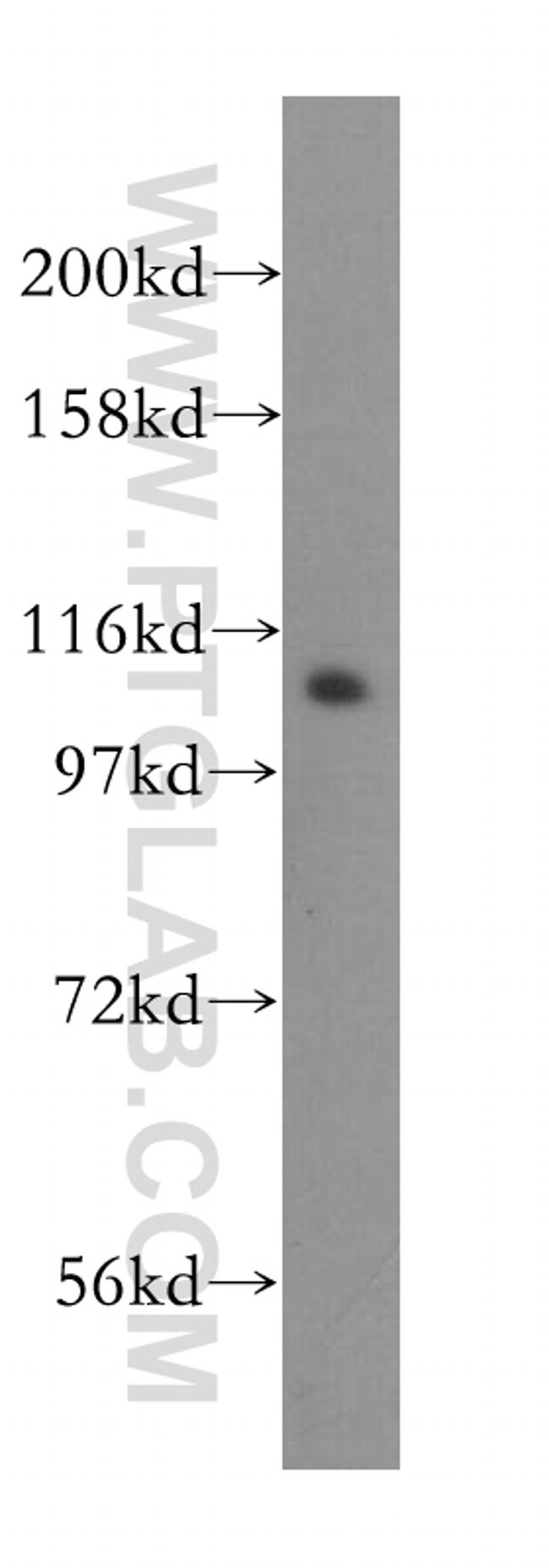 DIS3 Antibody in Western Blot (WB)