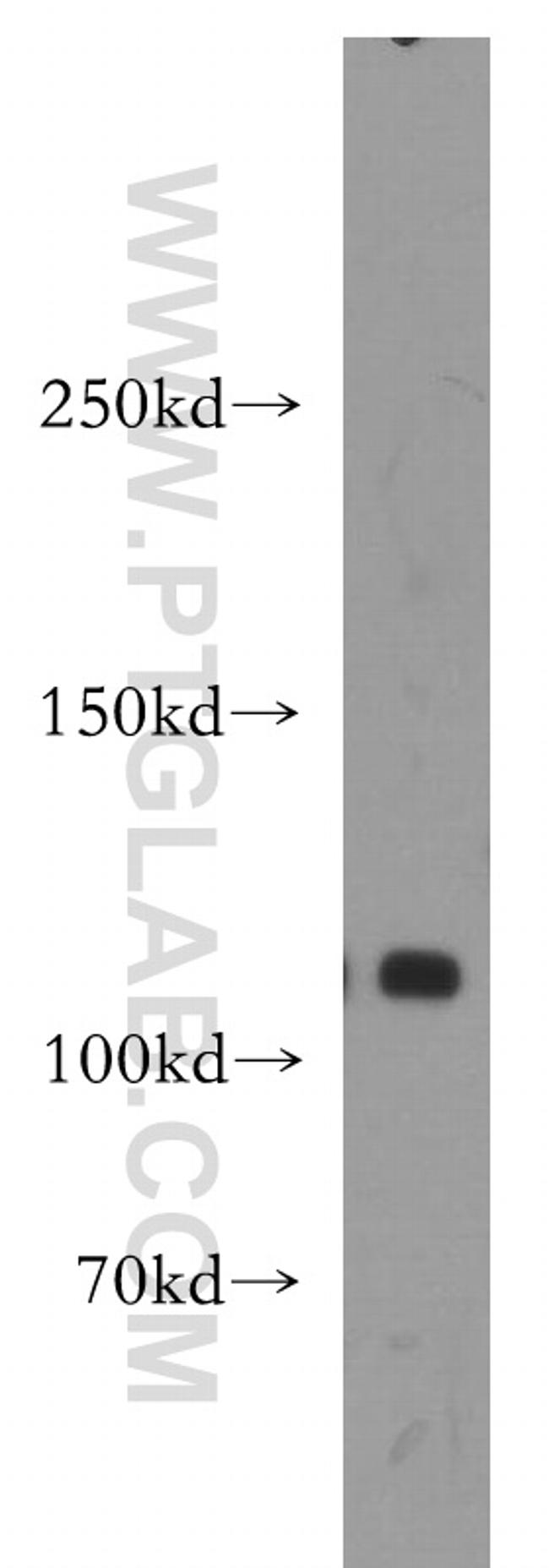 DIS3 Antibody in Western Blot (WB)