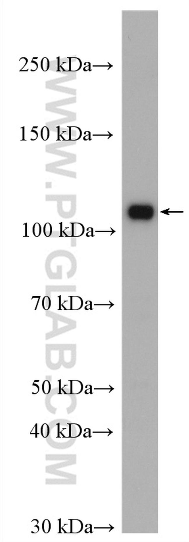 DIS3 Antibody in Western Blot (WB)