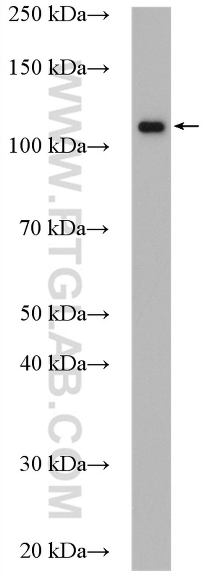 DIS3 Antibody in Western Blot (WB)