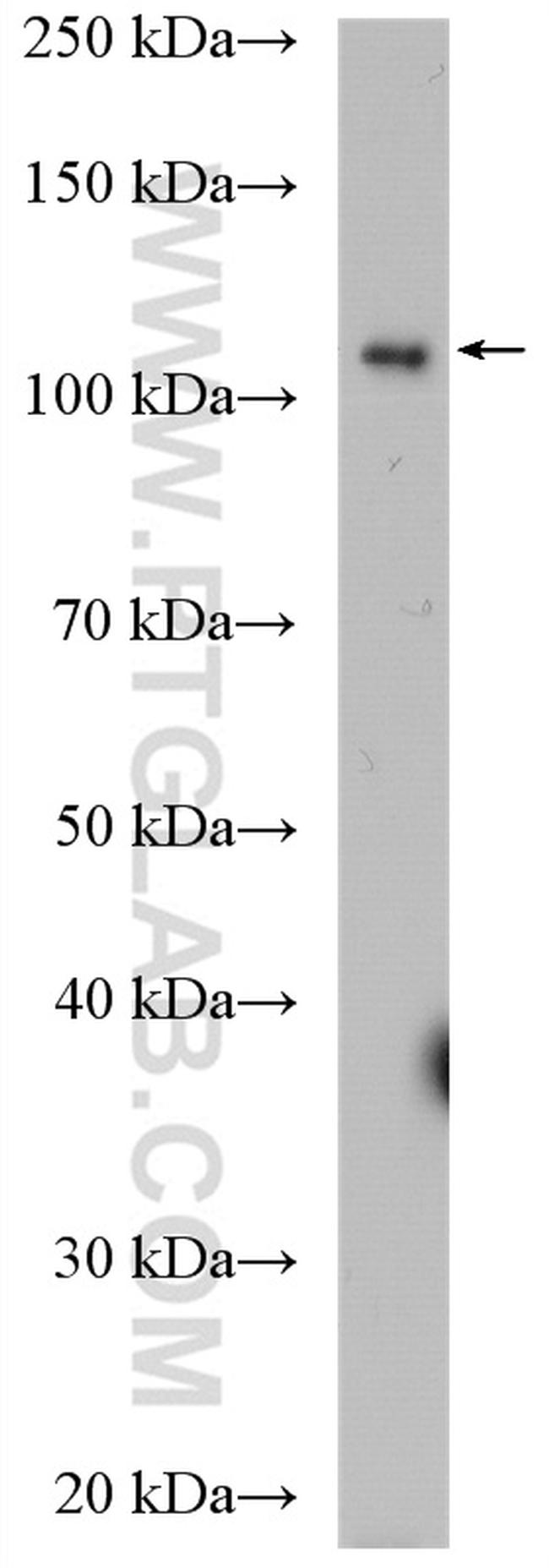 DIS3 Antibody in Western Blot (WB)