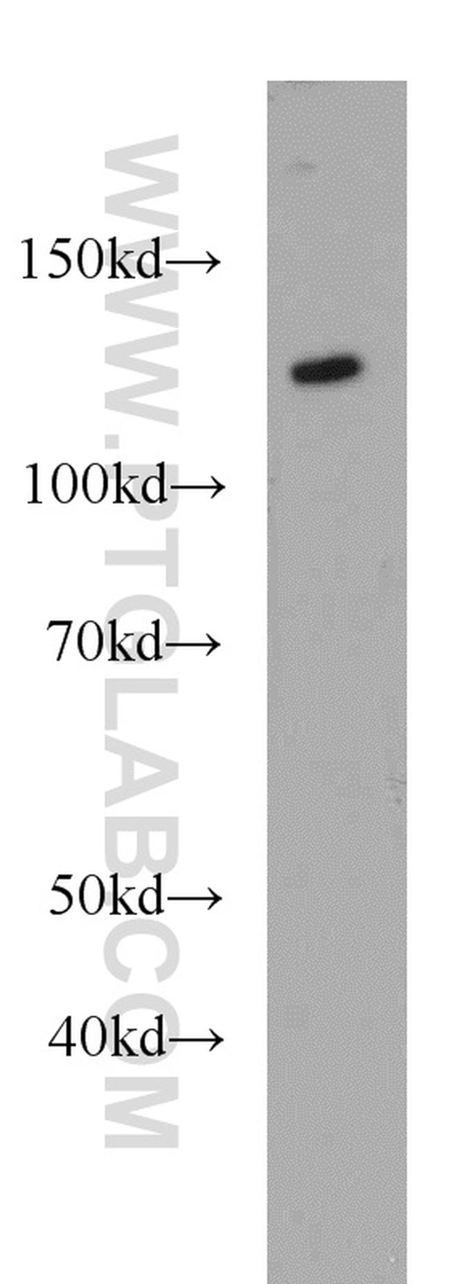 AGAP2 Antibody in Western Blot (WB)