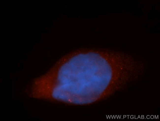 AGAP2 Antibody in Immunocytochemistry (ICC/IF)