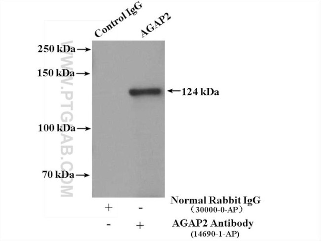 AGAP2 Antibody in Immunoprecipitation (IP)