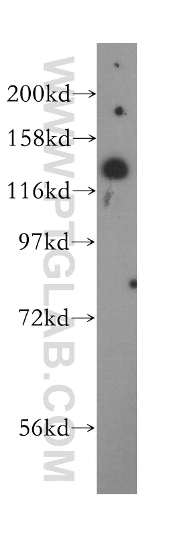 AGAP2 Antibody in Western Blot (WB)