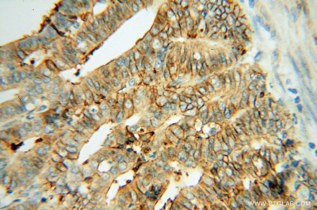 THEM4 Antibody in Immunohistochemistry (Paraffin) (IHC (P))