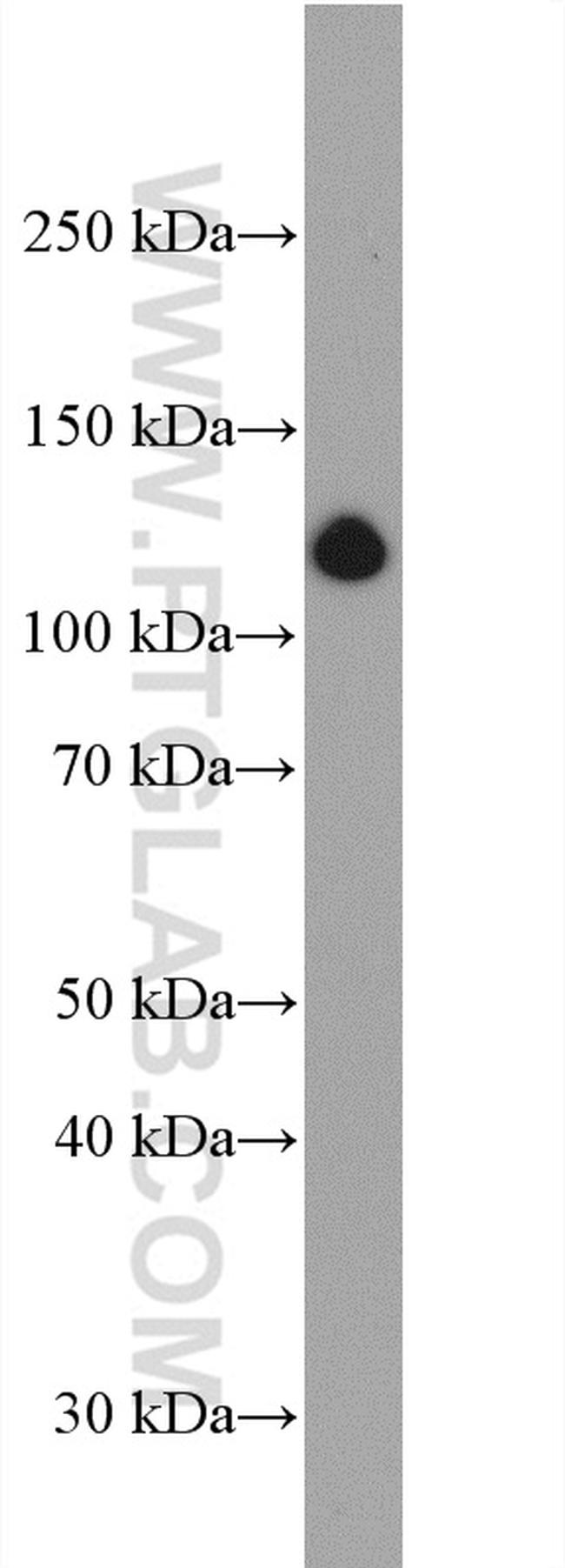 Collagen Type I Antibody in Western Blot (WB)