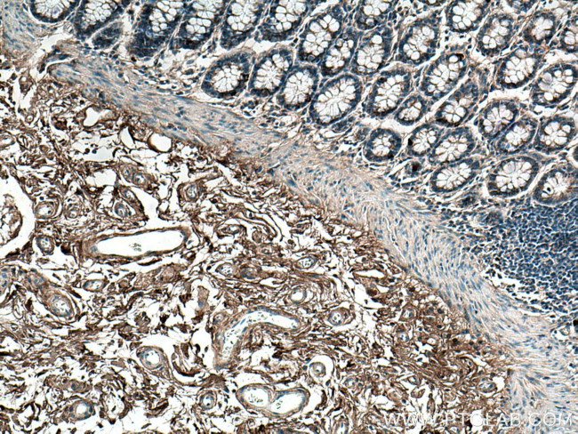 Collagen Type I Antibody in Immunohistochemistry (Paraffin) (IHC (P))