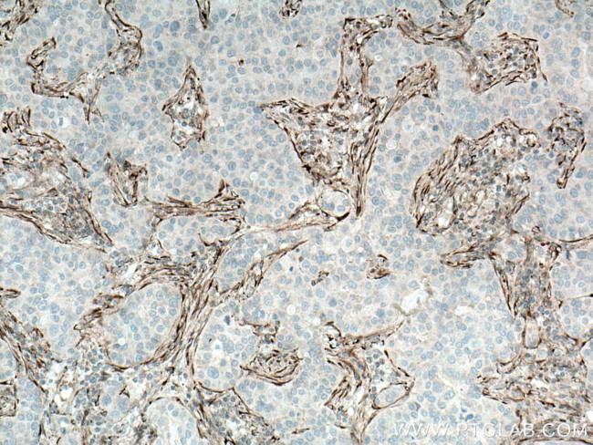 Collagen Type I Antibody in Immunohistochemistry (Paraffin) (IHC (P))