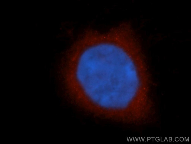 KCNAB1 Antibody in Immunocytochemistry (ICC/IF)