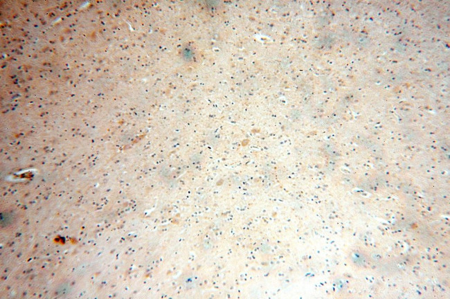 KCNAB1 Antibody in Immunohistochemistry (Paraffin) (IHC (P))