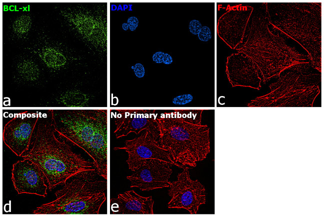 Bcl-X Antibody in Immunocytochemistry (ICC/IF)