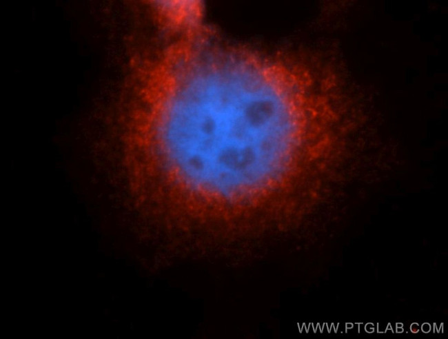 GRP94 Antibody in Immunocytochemistry (ICC/IF)