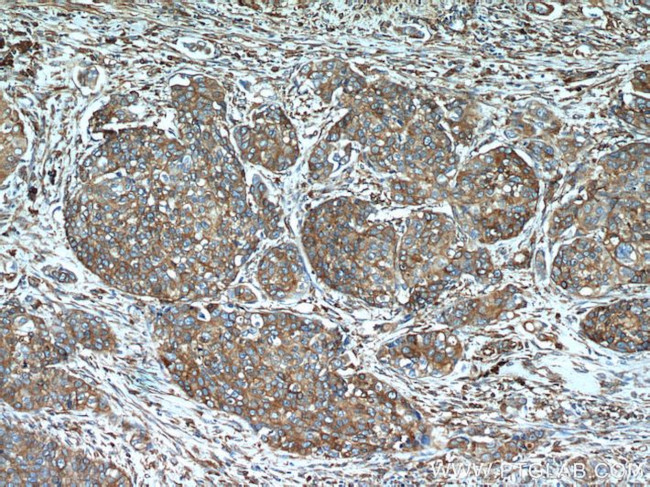 GRP94 Antibody in Immunohistochemistry (Paraffin) (IHC (P))