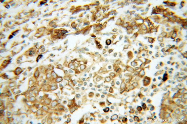 GRP94 Antibody in Immunohistochemistry (Paraffin) (IHC (P))