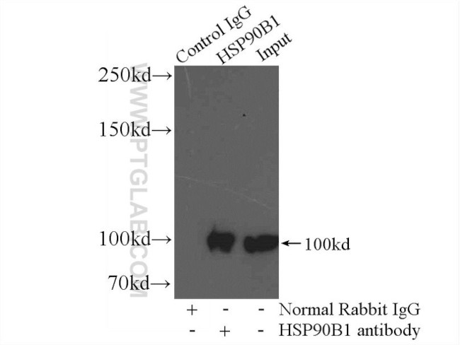 GRP94 Antibody in Immunoprecipitation (IP)