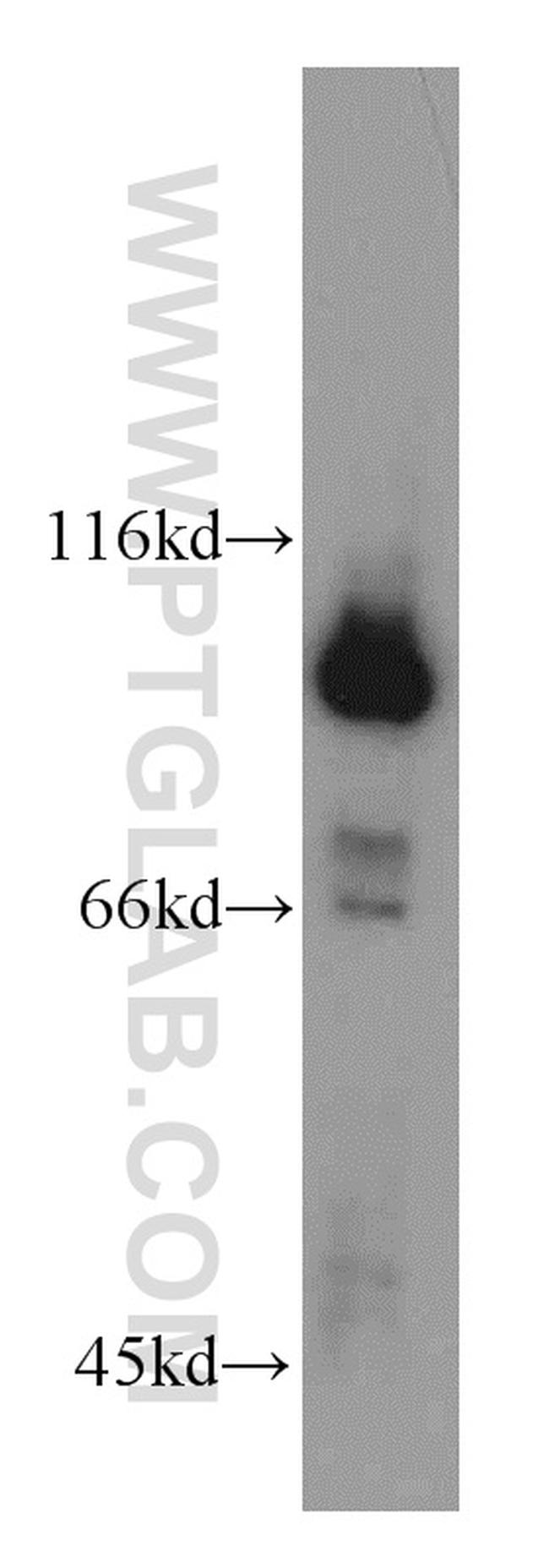 GRP94 Antibody in Western Blot (WB)