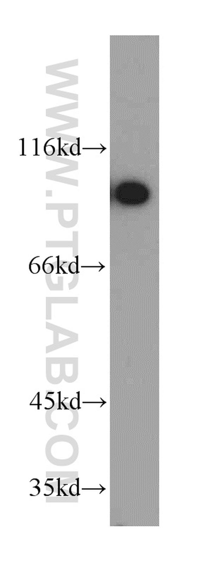 GRP94 Antibody in Western Blot (WB)