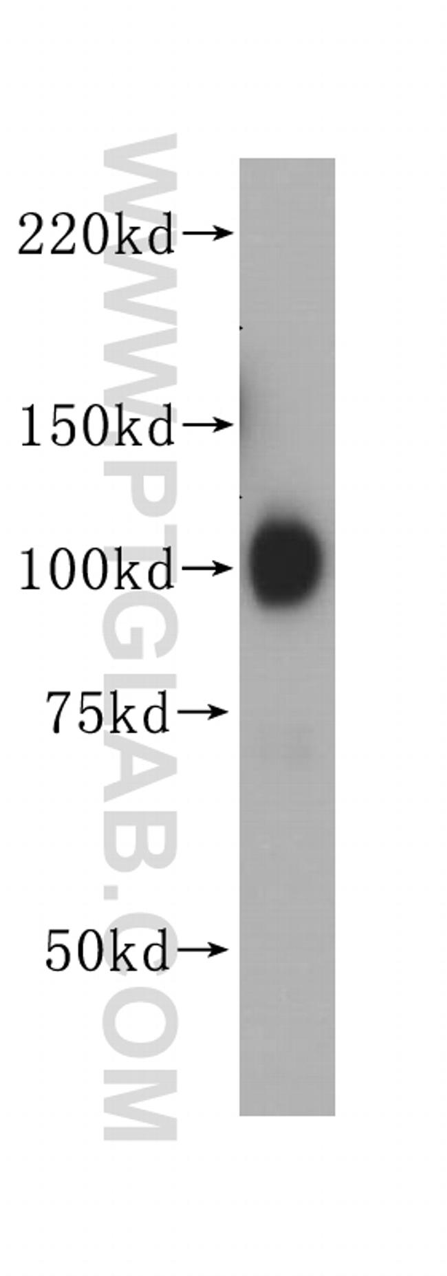 GRP94 Antibody in Western Blot (WB)