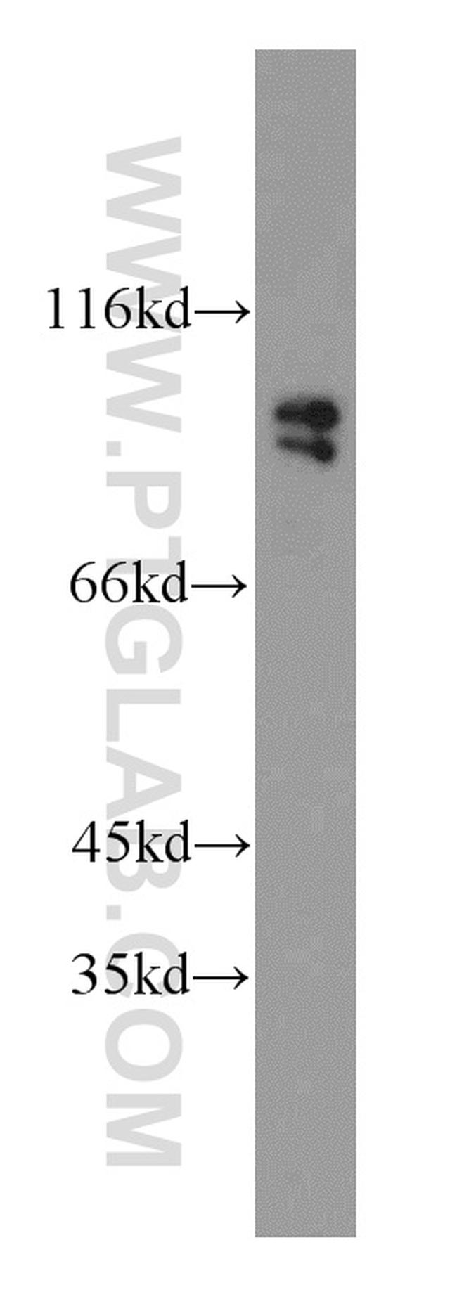 GRP94 Antibody in Western Blot (WB)