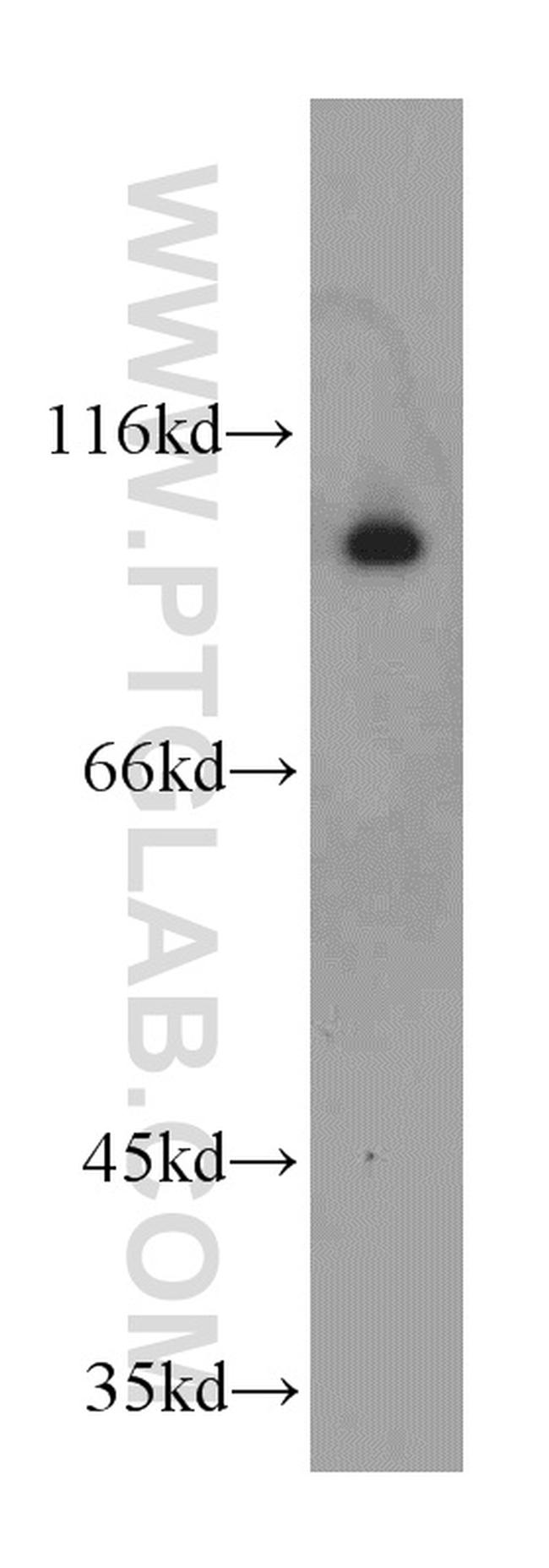 GRP94 Antibody in Western Blot (WB)