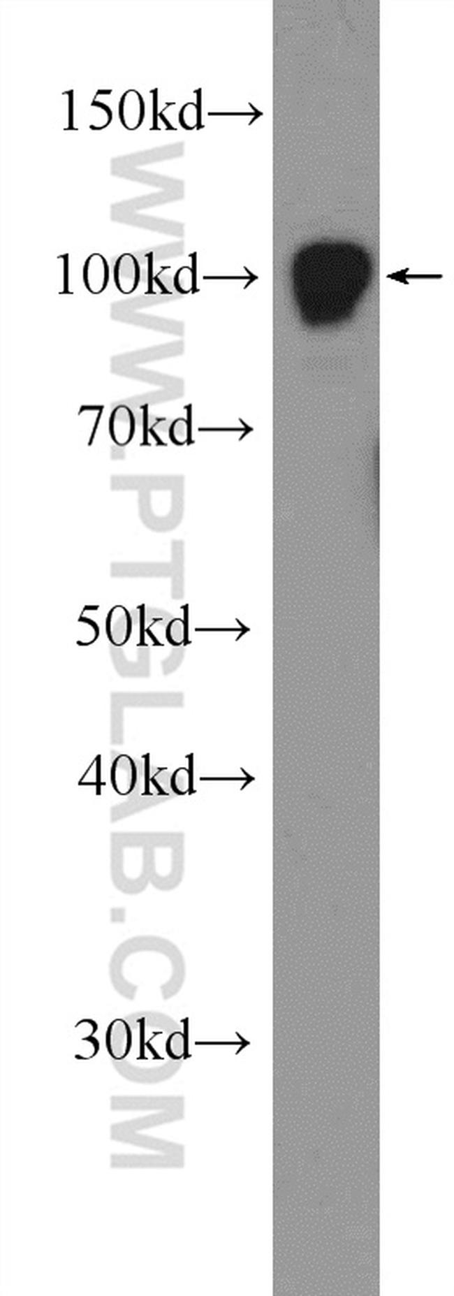 GRP94 Antibody in Western Blot (WB)