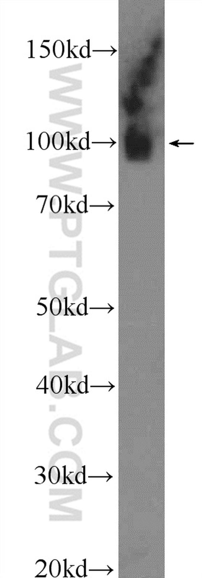 GRP94 Antibody in Western Blot (WB)