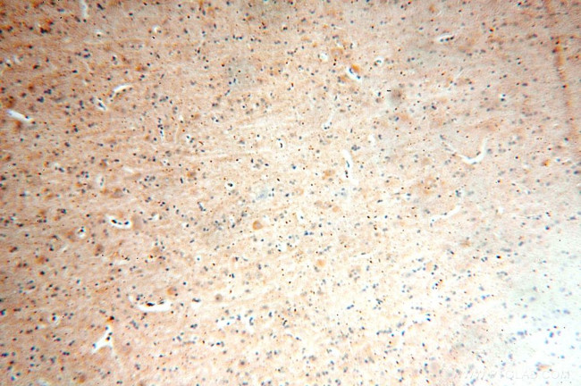 RPL19 Antibody in Immunohistochemistry (Paraffin) (IHC (P))