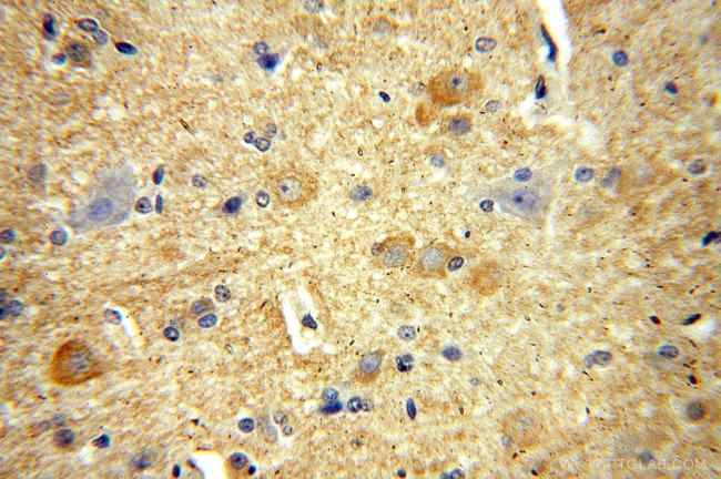 RPL19 Antibody in Immunohistochemistry (Paraffin) (IHC (P))