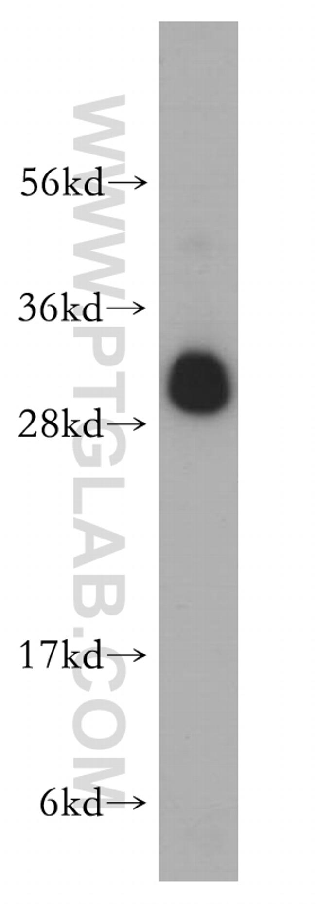 RPL19 Antibody in Western Blot (WB)