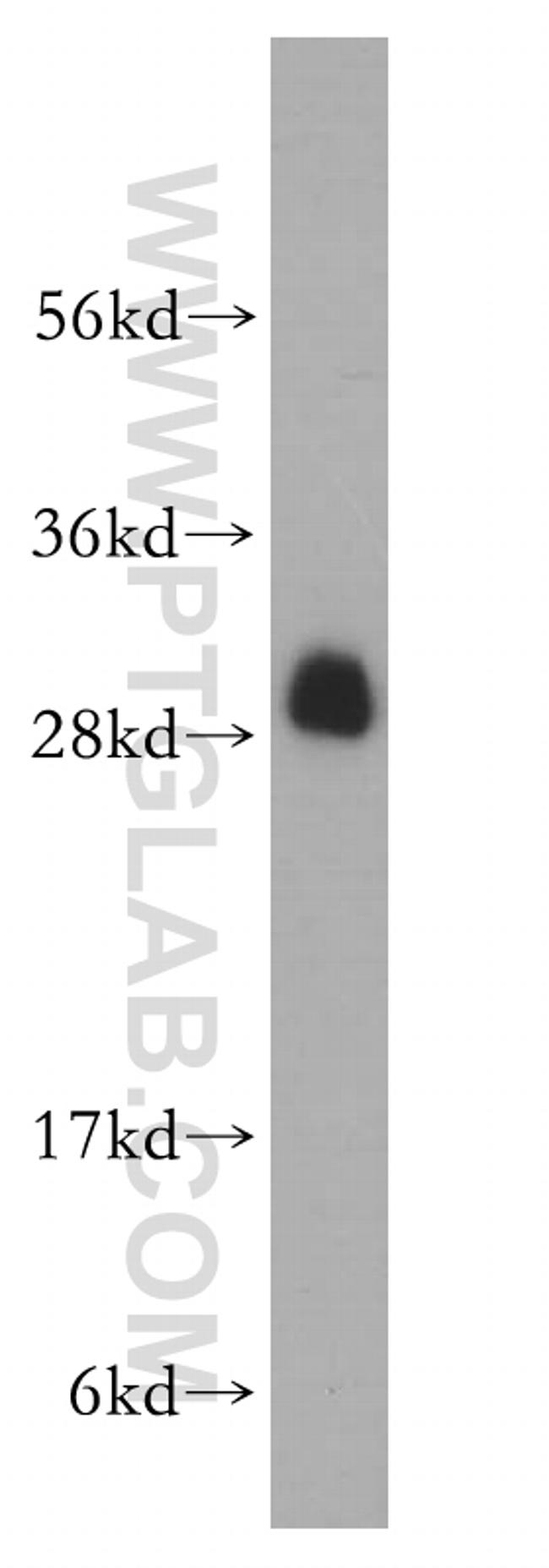 RPL19 Antibody in Western Blot (WB)