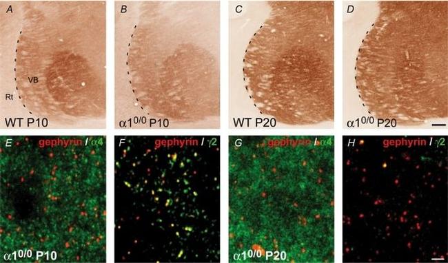 IL-1 alpha Antibody in Immunohistochemistry (IHC)