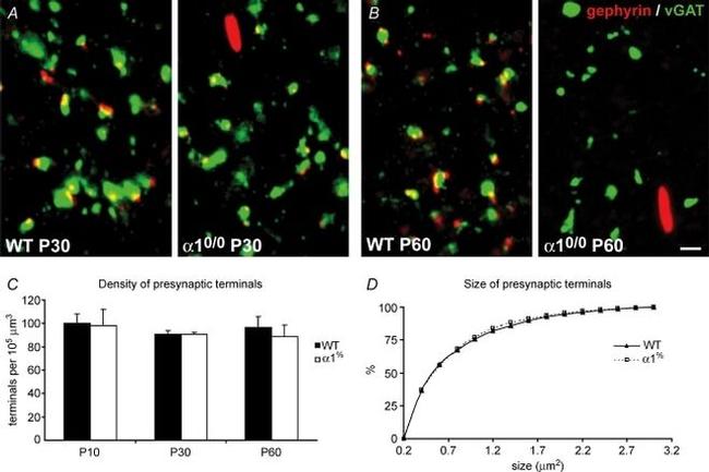 IL-1 alpha Antibody in Immunohistochemistry (IHC)