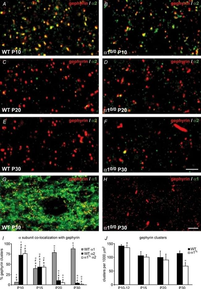 IL-1 alpha Antibody in Immunohistochemistry (IHC)