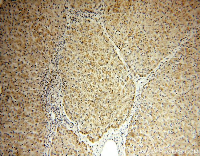 RNMTL1 Antibody in Immunohistochemistry (Paraffin) (IHC (P))