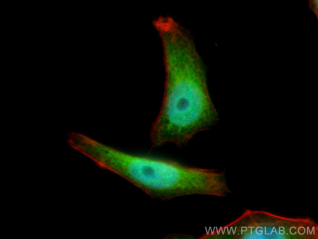 MGEA5 Antibody in Immunocytochemistry (ICC/IF)