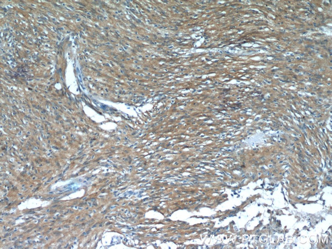 MGEA5 Antibody in Immunohistochemistry (Paraffin) (IHC (P))