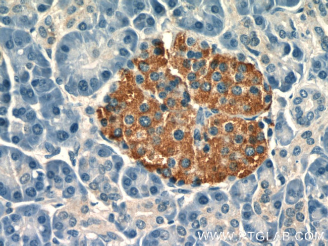 MGEA5 Antibody in Immunohistochemistry (Paraffin) (IHC (P))