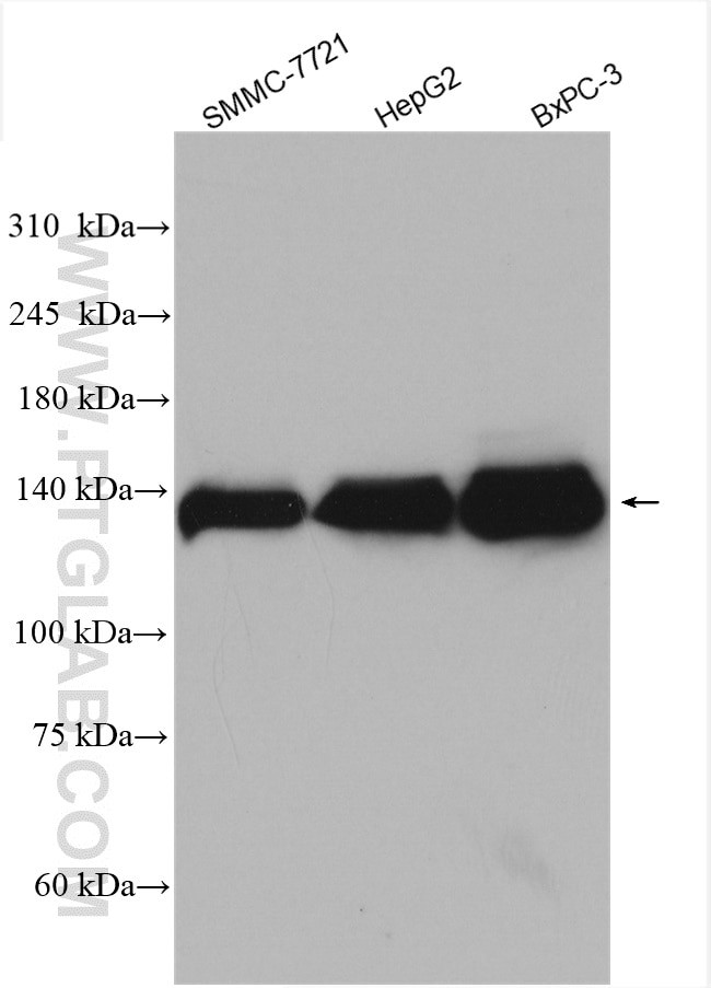 MGEA5 Antibody in Western Blot (WB)