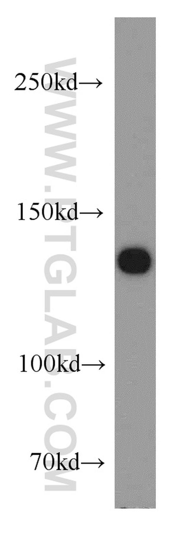 MGEA5 Antibody in Western Blot (WB)