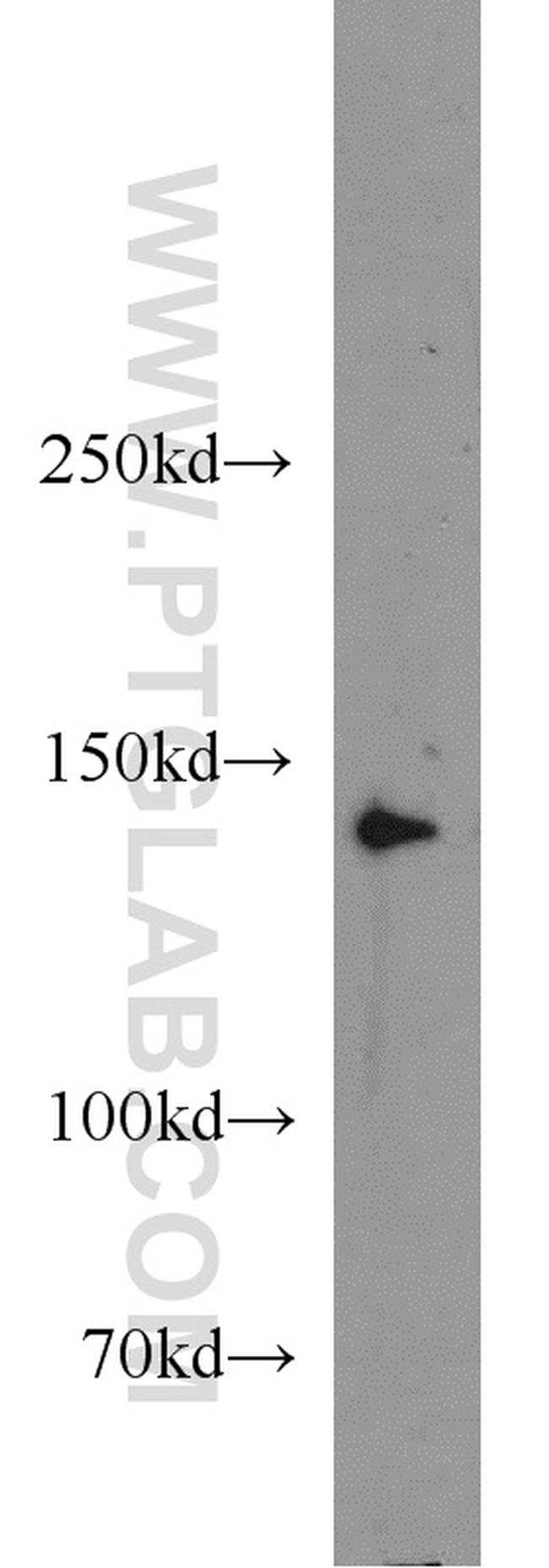 MGEA5 Antibody in Western Blot (WB)